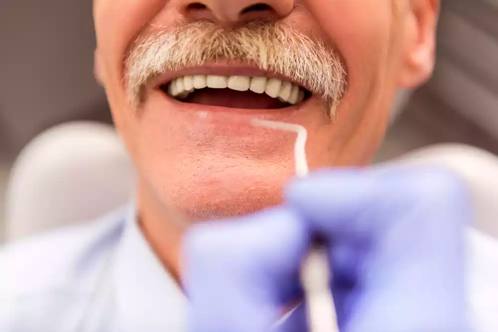 All On 6 Implants In Tijuana 9 old man
