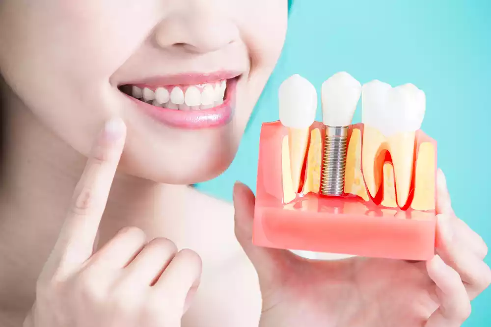 benefits of dental implants