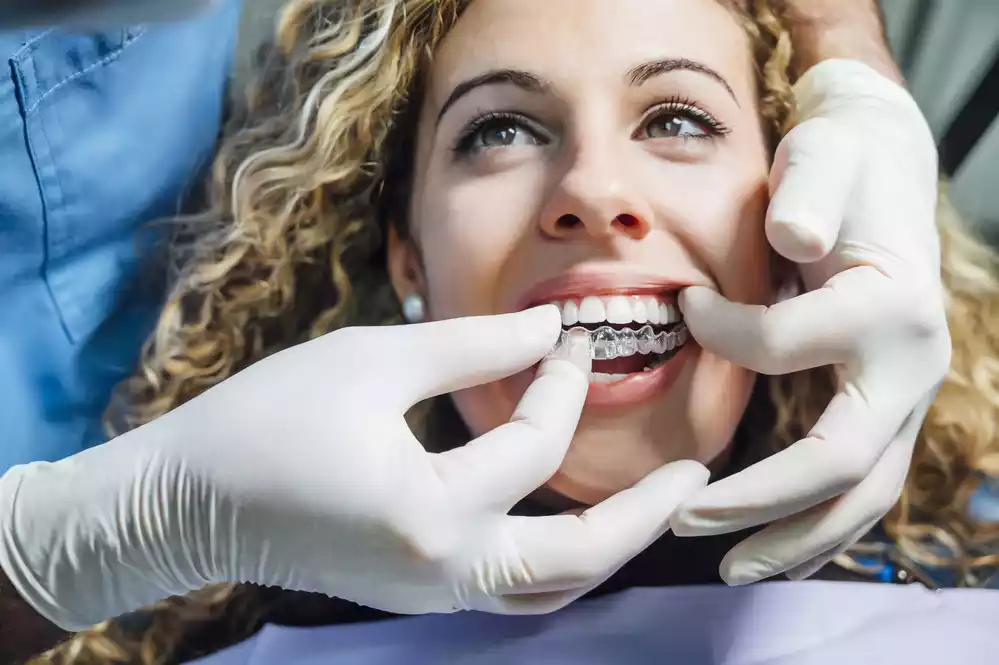 What Exactly Do Retainers for Teeth Do? 10 retainers (2)