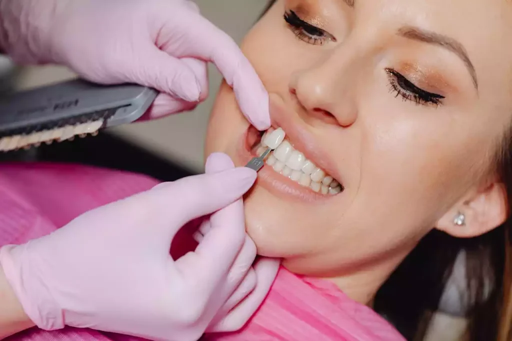 What are veneers and when are they a good option? 2 what are veneers