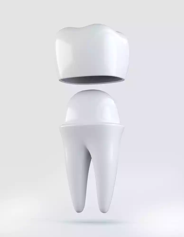 dental crowns