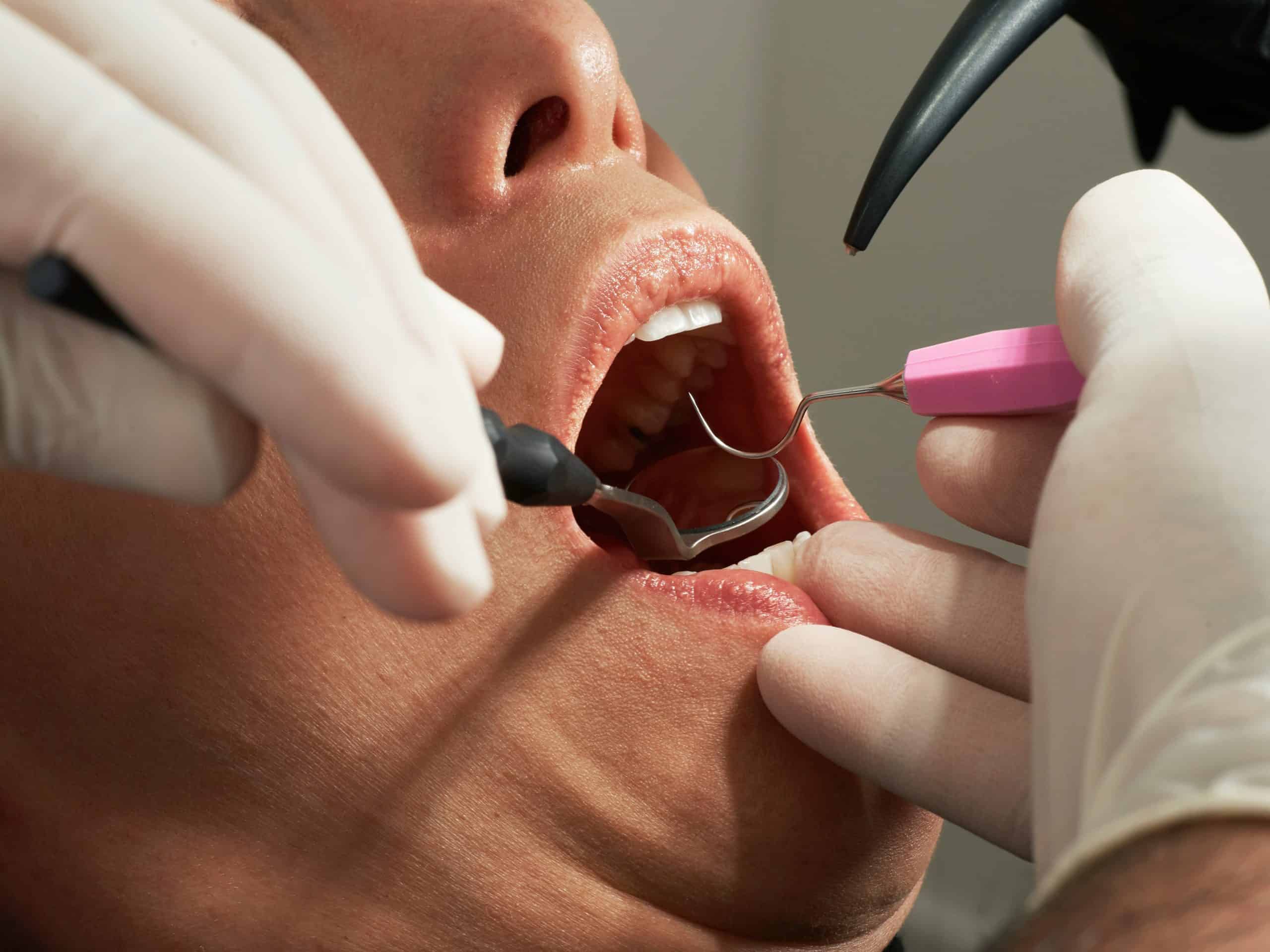 What to expect during your first dental visit 9 photo 1606811951341 756fdd437682 scaled 2098
