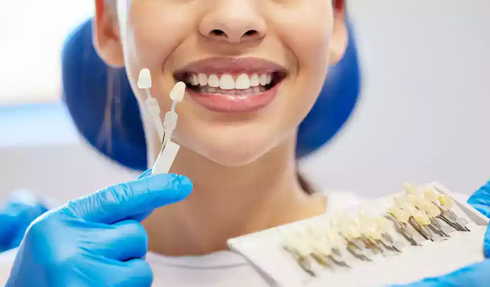 veneers care