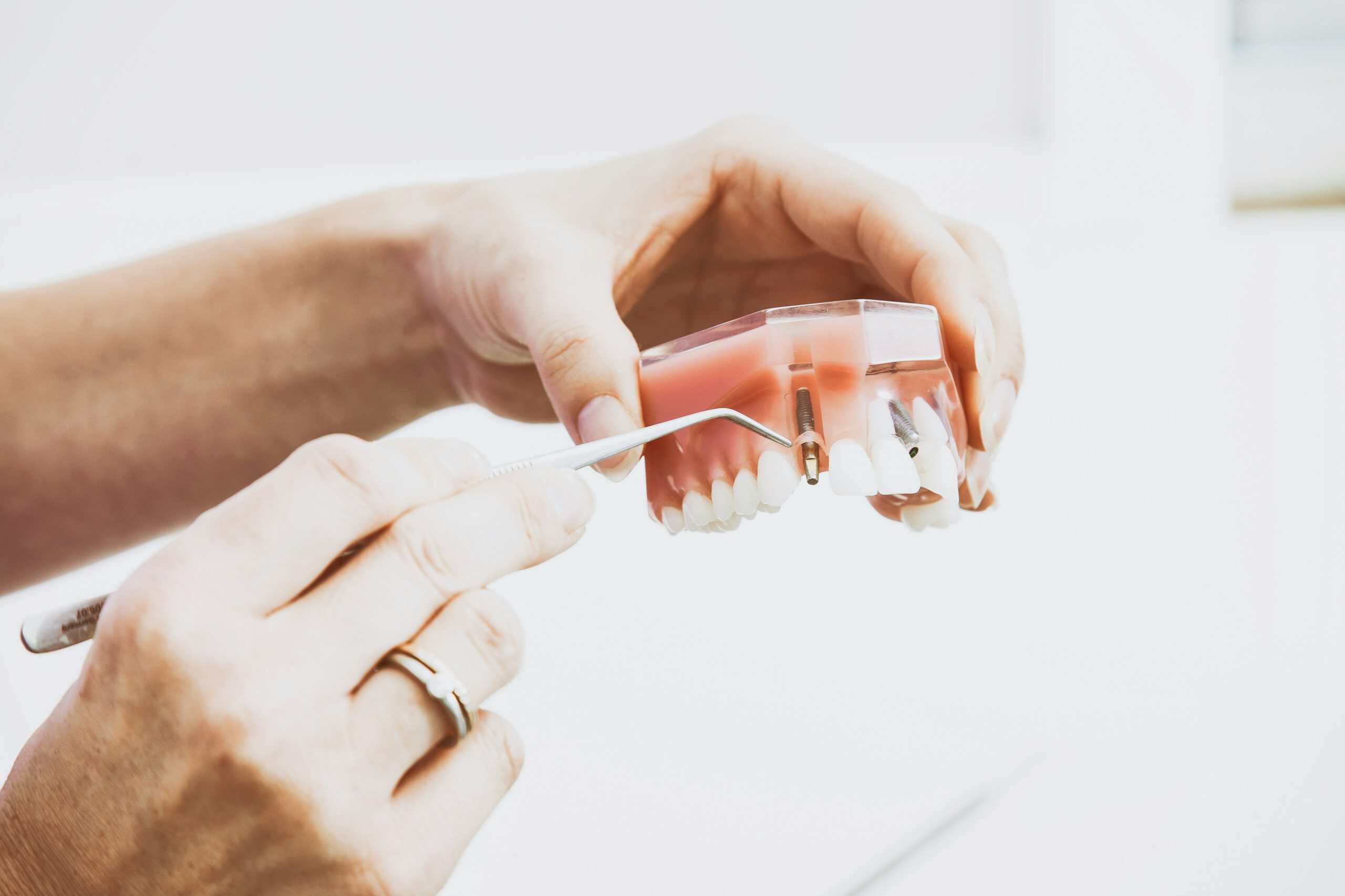 dental implant recovery